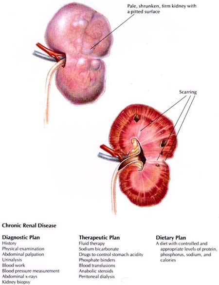 Acute Kidney Disease